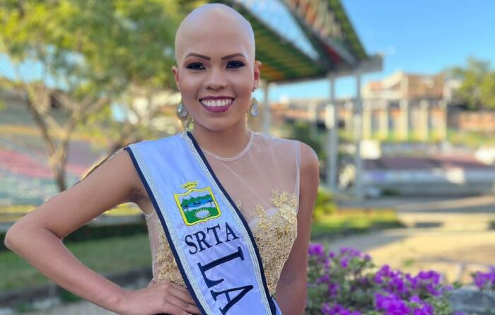 Xiomara breaks beauty stereotypes in the sampedrinas rounds • La Nación